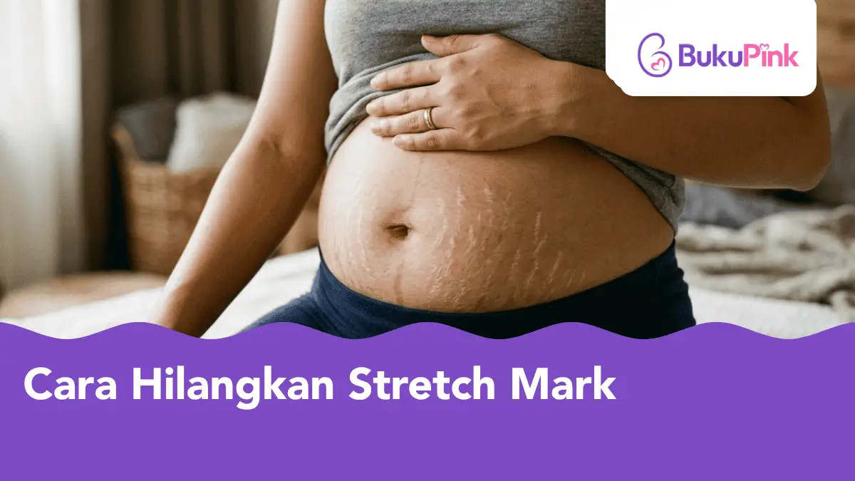 cara hilangkan stretch mark