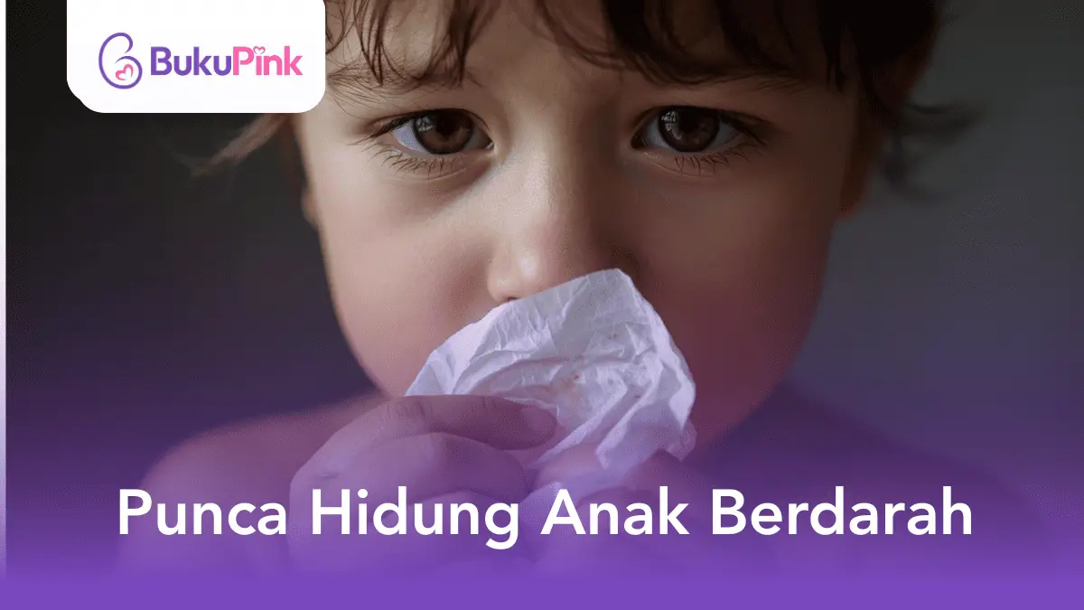 punca hidung anak berdarah