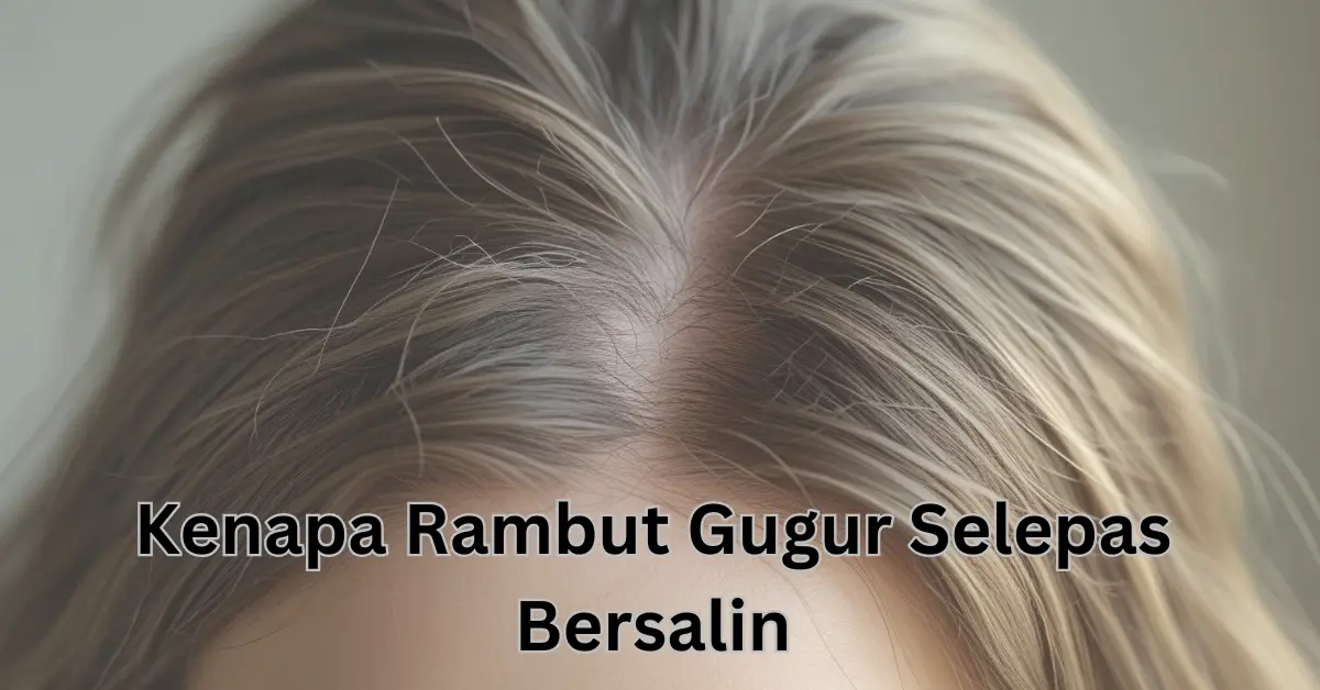 rambut gugur selepas bersalin