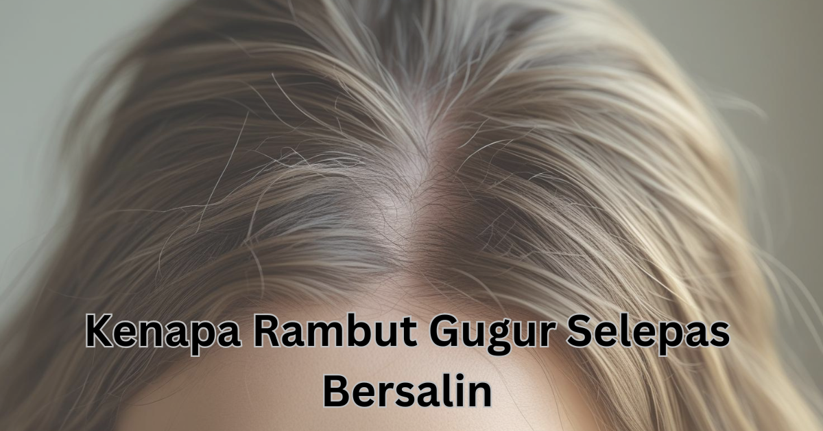 rambut gugur selepas bersalin