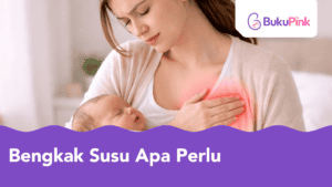 bengkak susu apa perlu buat